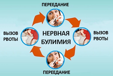 Лечение булимии в Вурнарах